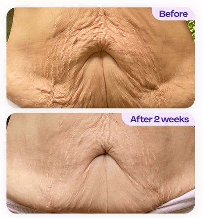 Tighten & Smooth Belly Cream