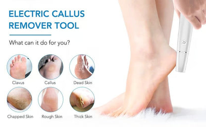 Hot Sale - 49% OFF🌸Electric Feet Callus Remover
