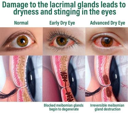 Eyeworldpark™ Nano Vision Repair Eye Serum ✅FDA Approved(Suitable for presbyopia, dry eye syndrome, glaucoma, and cataracts)