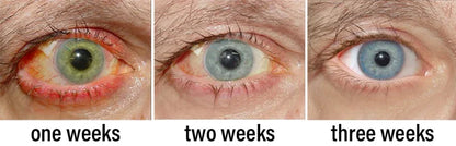 Eyeworldpark™ Nano Vision Repair Eye Serum ✅FDA Approved(Suitable for presbyopia, dry eye syndrome, glaucoma, and cataracts)