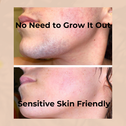 BUY 1 GET 1 FREE 49%off Hair Removal Kit
