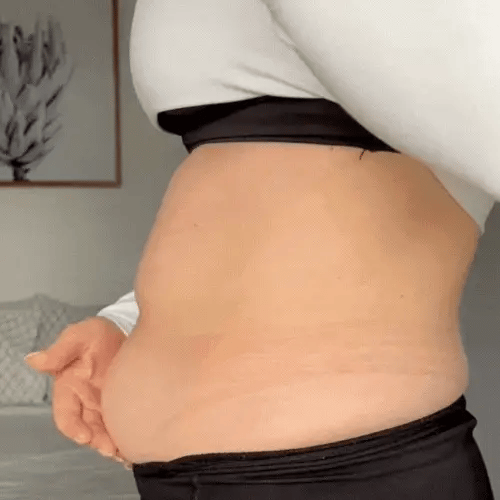 Instant Lift & Glow – Invisible Firming Patches