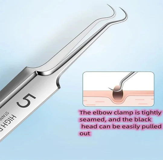 HOT SALE 49% off - Professional Facial Blackhead Remover Tweezers