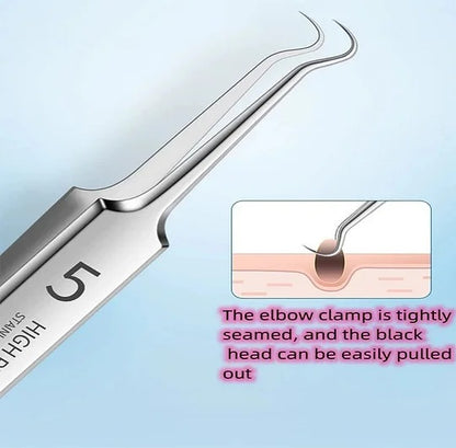 HOT SALE 49% off - Professional Facial Blackhead Remover Tweezers