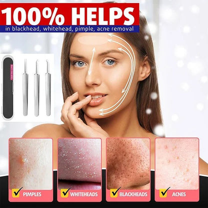 HOT SALE 49% off - Professional Facial Blackhead Remover Tweezers