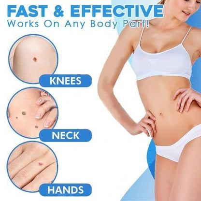 Hot sale 49% off🔥Auto Tag Rapid Removal Kit