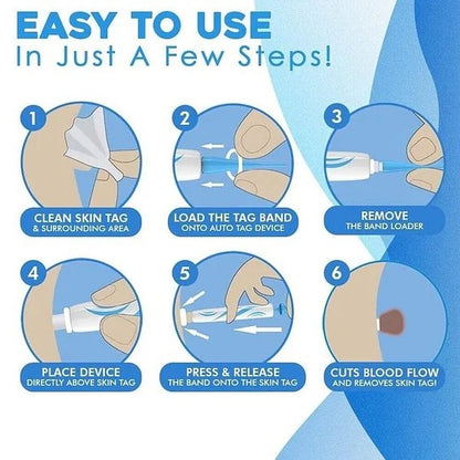 Hot sale 49% off🔥Auto Tag Rapid Removal Kit