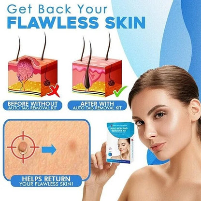 Hot sale 49% off🔥Auto Tag Rapid Removal Kit