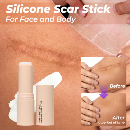 [⚡ Limited Offer! 49% OFF]SCAR SOLUTIONS - Silicone Scar Stick - For Face and Body