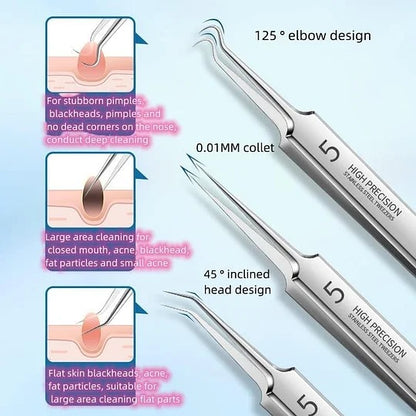 HOT SALE 49% off - Professional Facial Blackhead Remover Tweezers