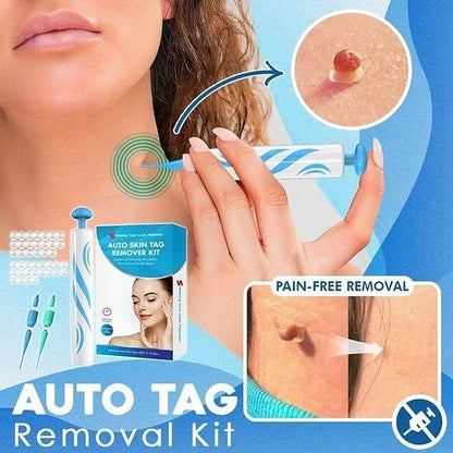 Hot sale 49% off🔥Auto Tag Rapid Removal Kit