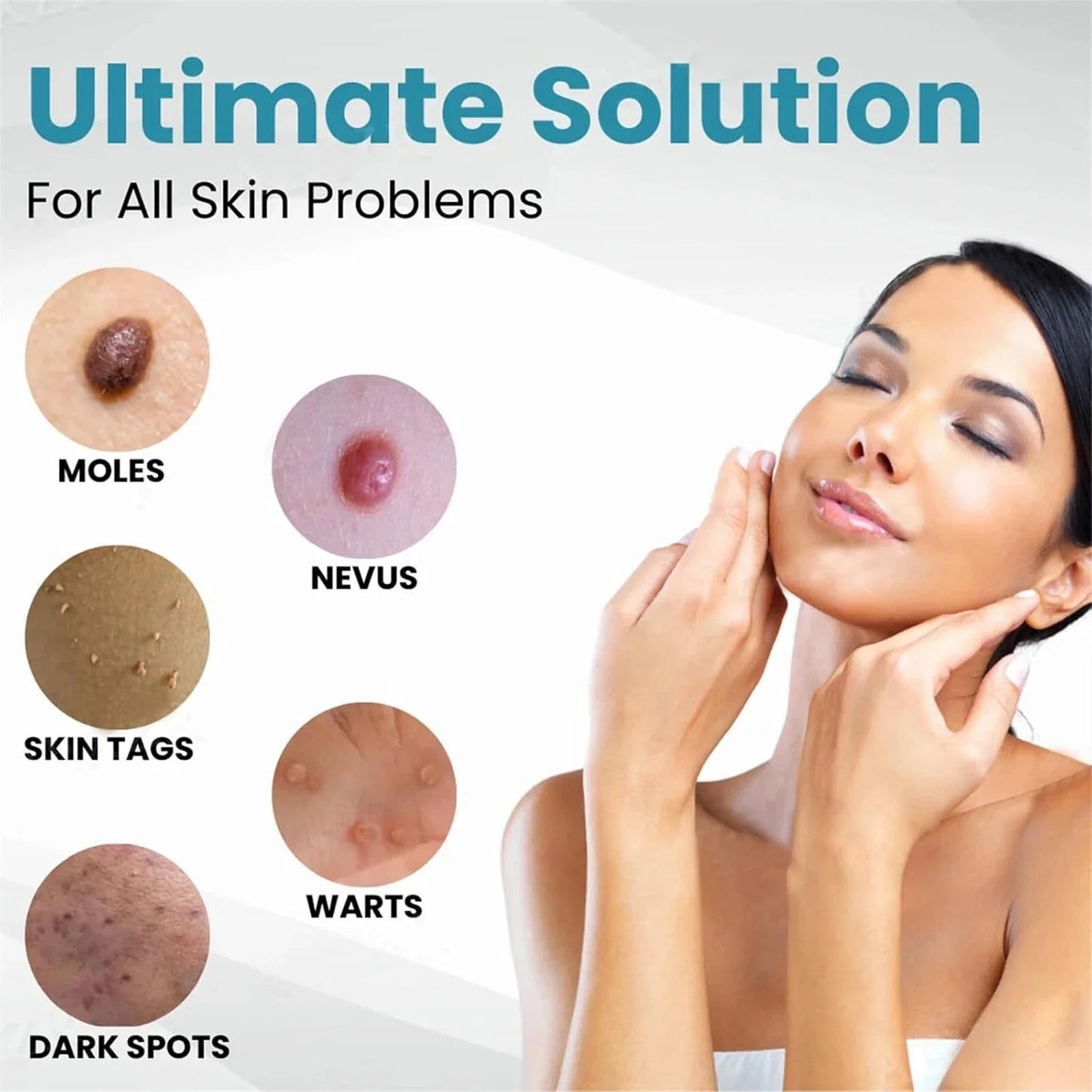 Hot Sale 49% off - Non-Invasive Mole and Wart Removal Laser Pen