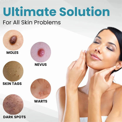 Hot Sale 49% off - Non-Invasive Mole and Wart Removal Laser Pen