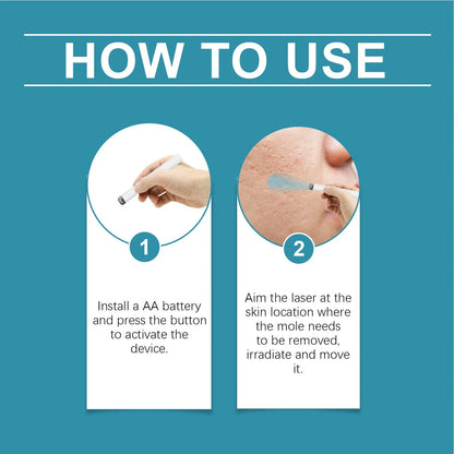 Hot Sale 49% off - Non-Invasive Mole and Wart Removal Laser Pen